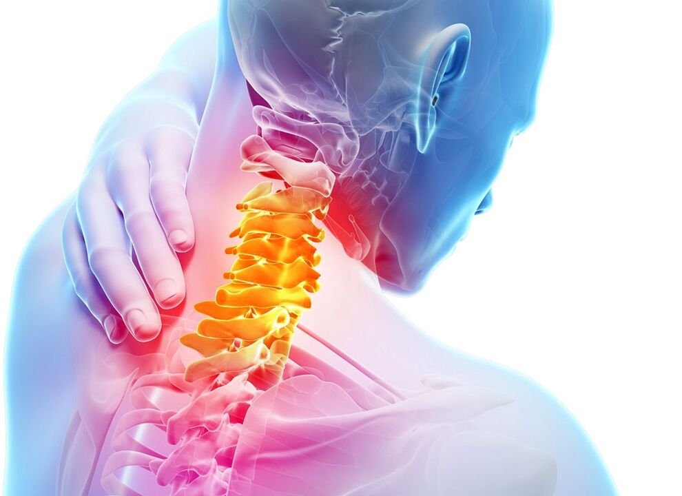 servikal osteokondroz belirtileri